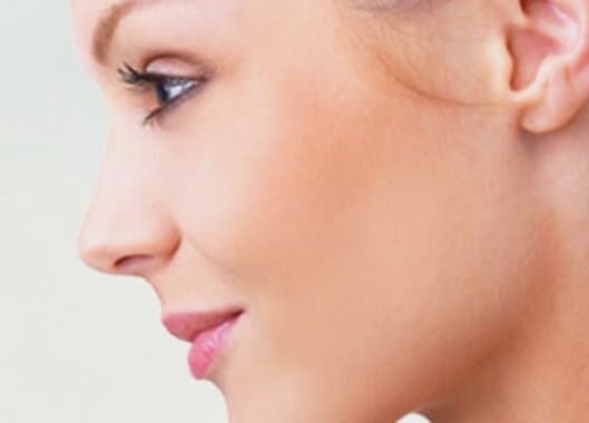 Depilación de parcial del rostro